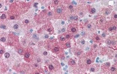 Immunohistochemistry-Paraffin: GCNT3 Antibody [NBP3-14332]